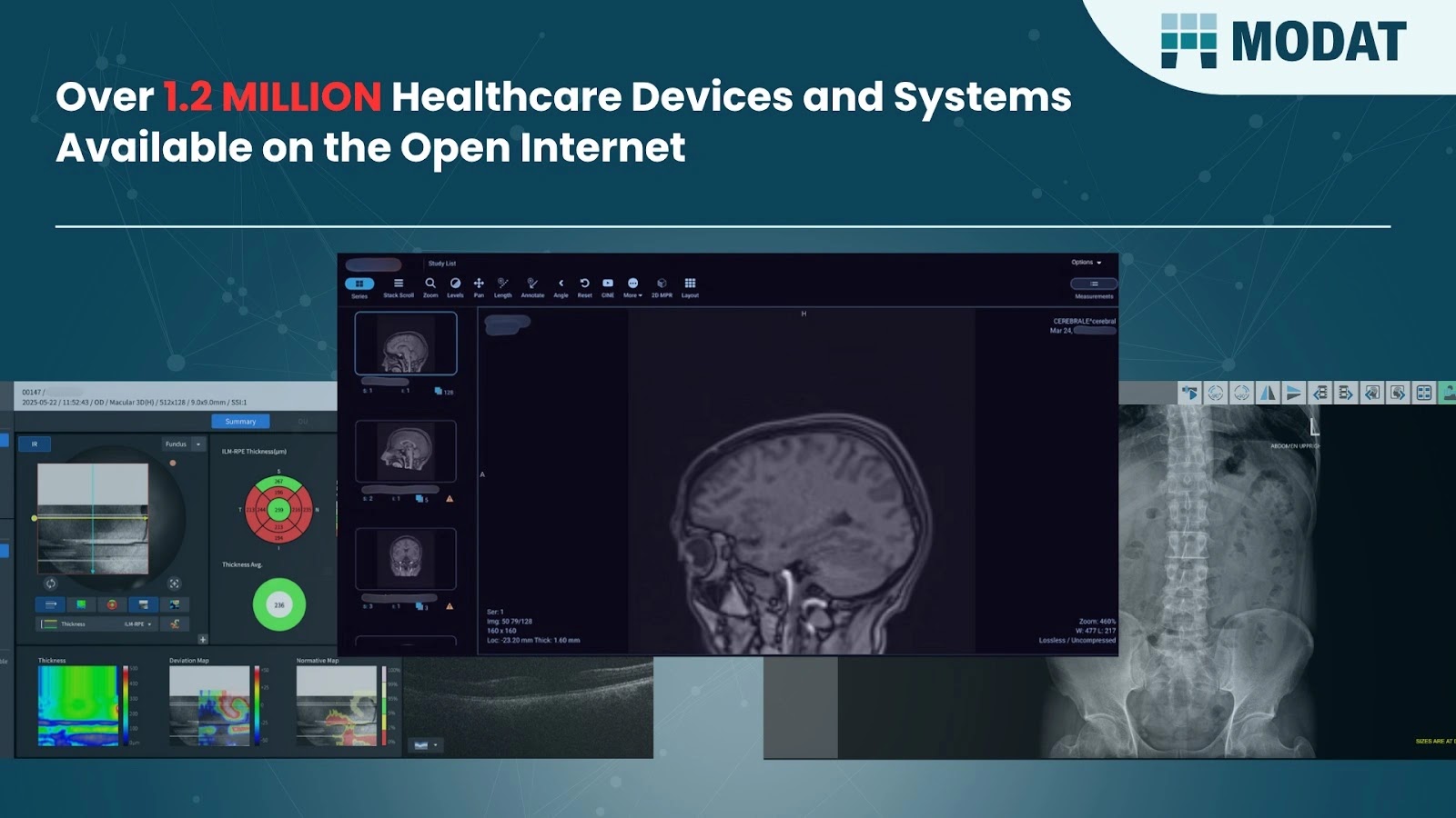 1.2 Million Healthcare Devices and Systems Found Exposed Online